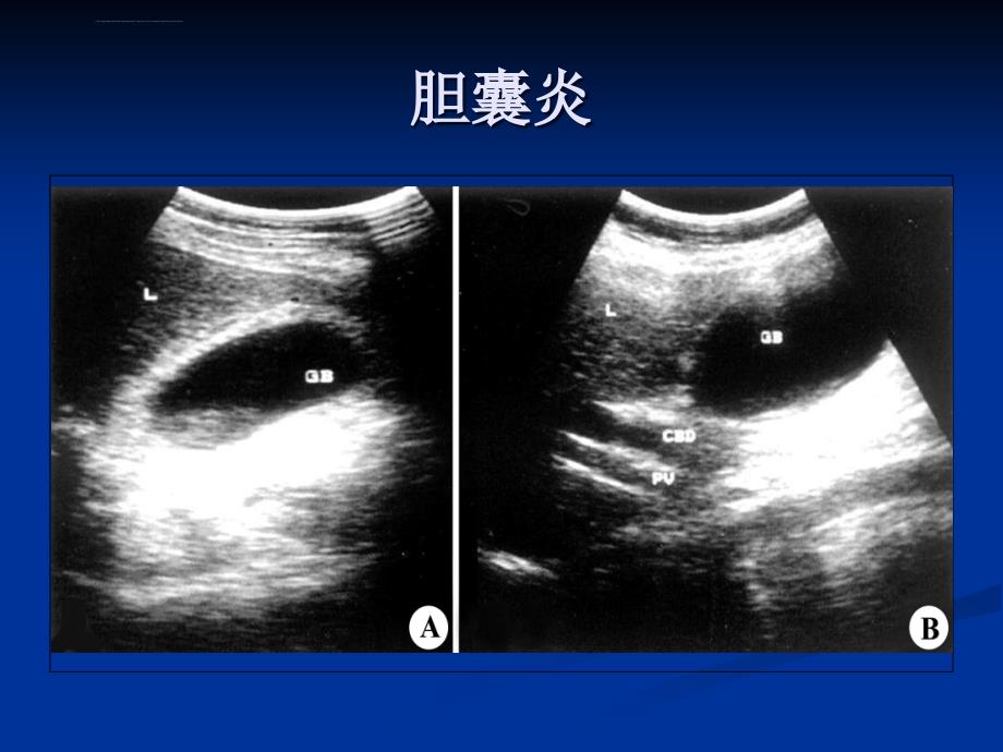 执业医师技能考试—b超ppt培训课件_第4页