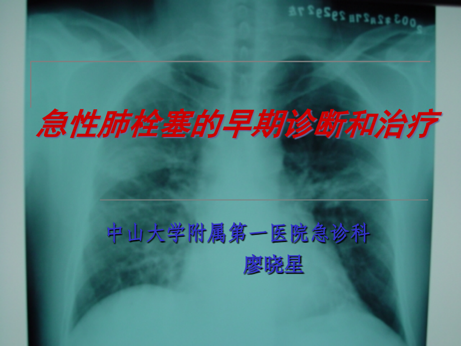 急性肺栓塞的早期诊断和治疗ppt培训课件_第1页