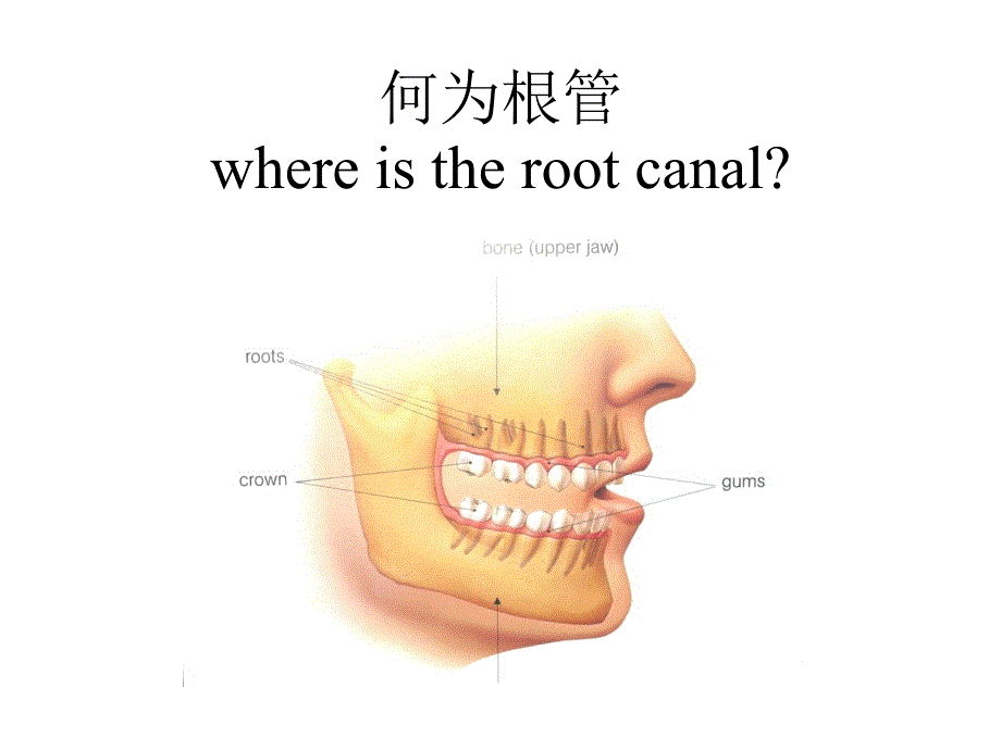 为何要做根管治疗课件_第2页