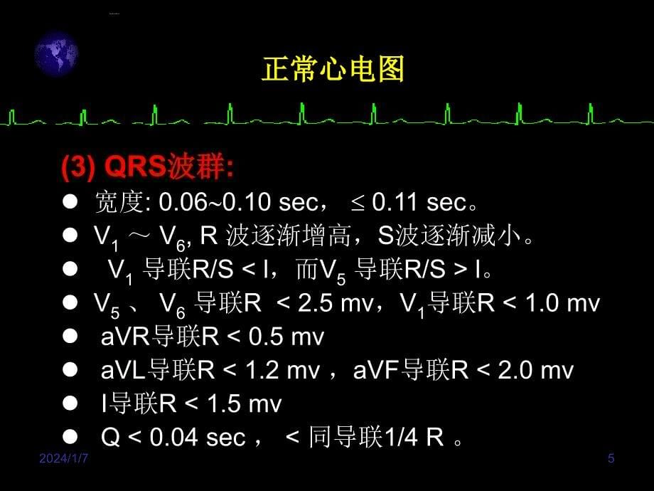 心电图入门讲座ppt培训课件_第5页