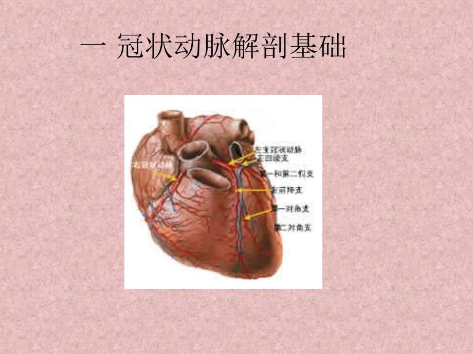 冠脉造影浅述ppt培训课件_第3页