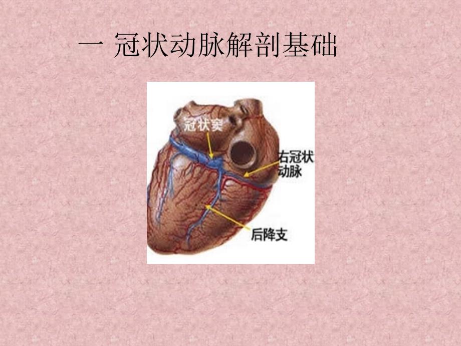 冠脉造影浅述ppt培训课件_第4页