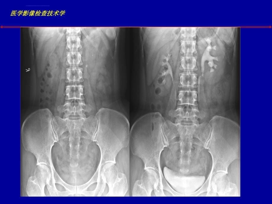 影像对比度ppt培训课件_第5页