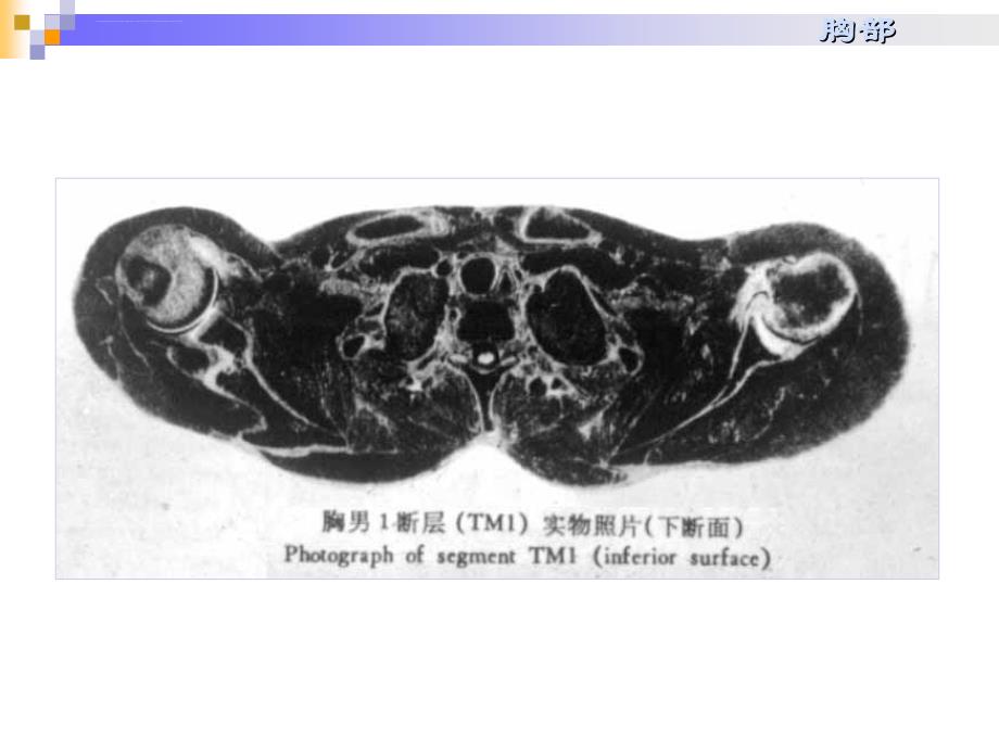 人体解剖断层课件_第3页