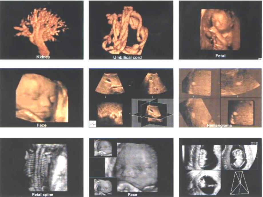 胎儿中枢神经系统异常的超声诊断课件_第1页