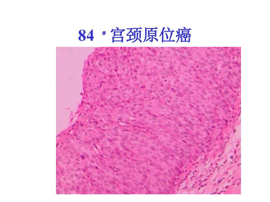 病理学1生殖系统疾病课件_第4页