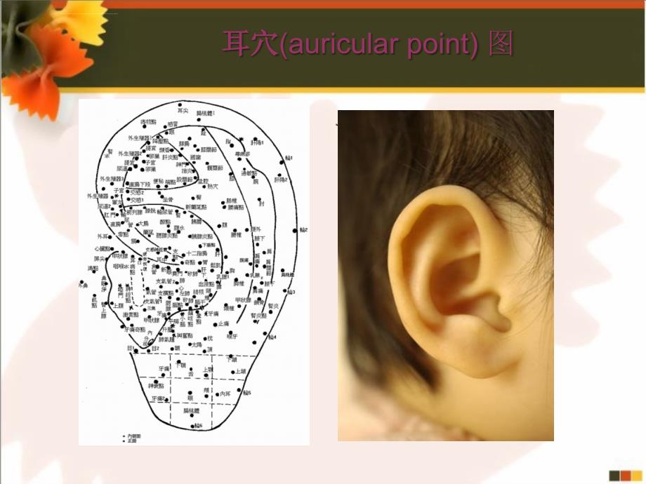 自编耳穴记忆歌诀课件_第2页