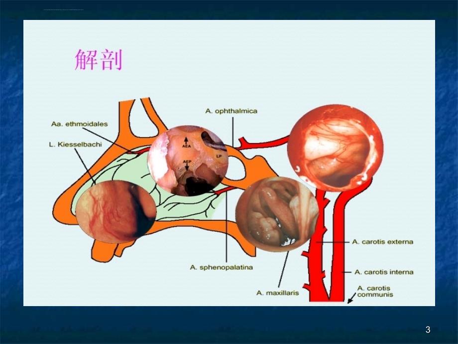 鼻出血分析课件_第3页