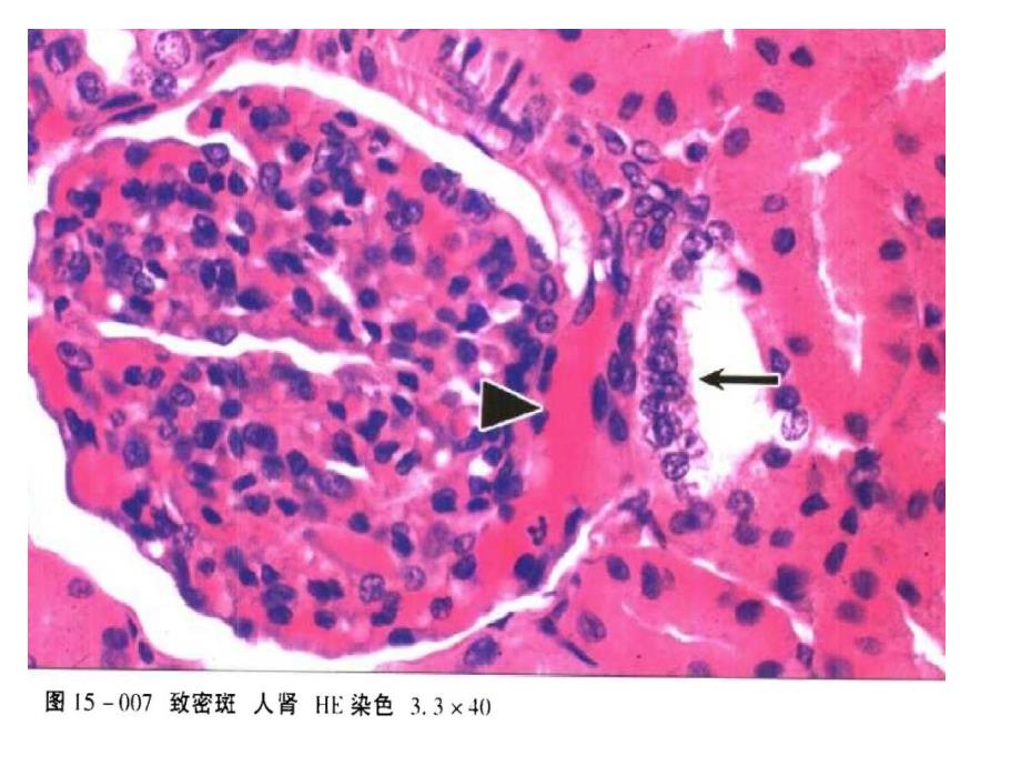 组织损伤与修复实验分析课件_第3页