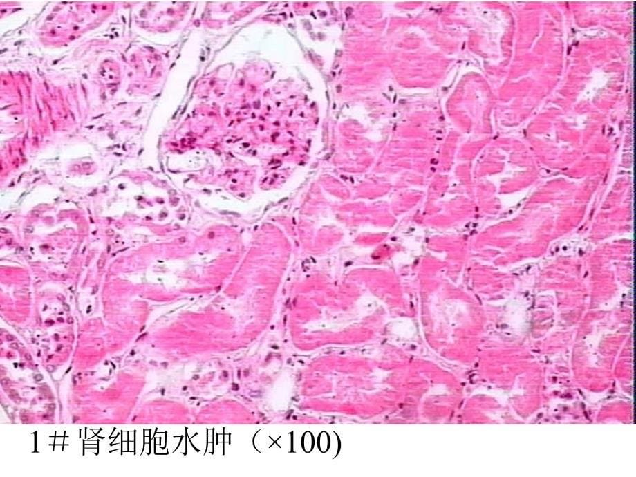 组织损伤与修复实验分析课件_第5页