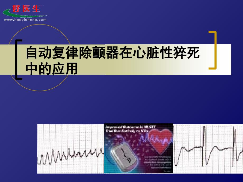 自动复律除颤器在心脏性猝死中的应用ppt培训课件_第1页
