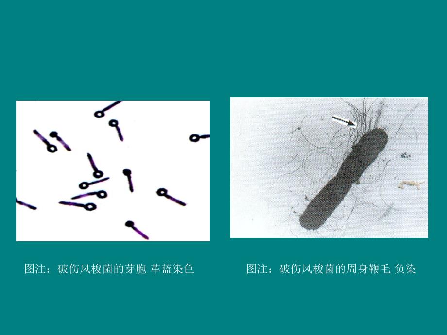 课件 破伤风梭菌_第4页