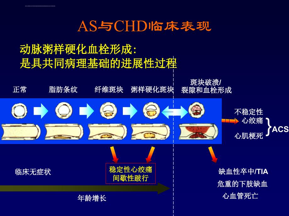 稳定型心绞痛诊断治疗_第2页