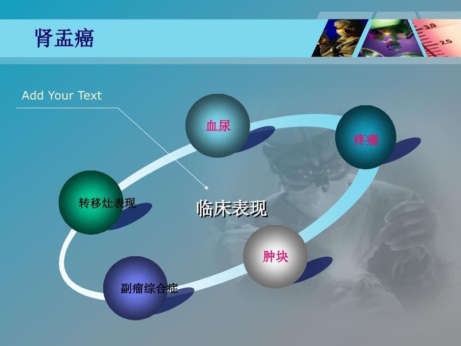 肾盂癌护理查房_第5页