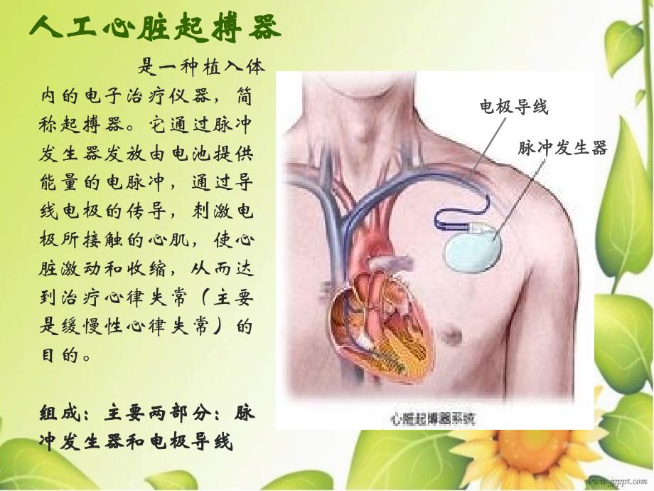 心脏永久起搏器植入术的护理方案_第3页