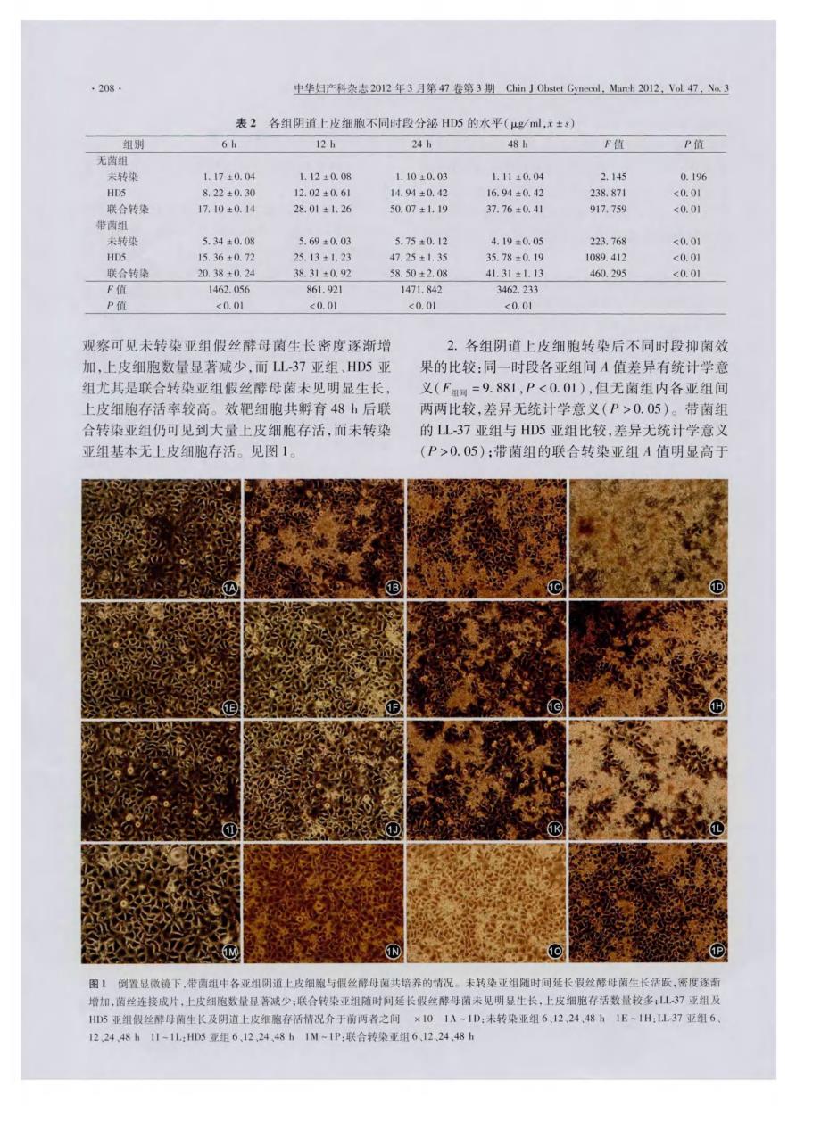 阴道上皮细胞转染抗菌肽LL-37和防御素5后对假丝酵母菌的抑制作用_第4页