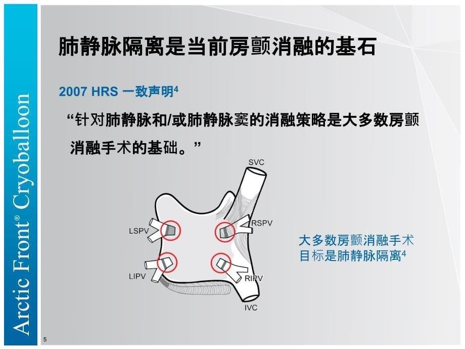 什么是阵发性房颤的冷冻消融_第5页