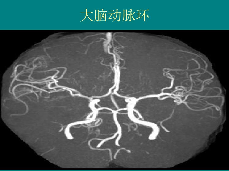 多排螺旋CT的临床应用 课件_第4页