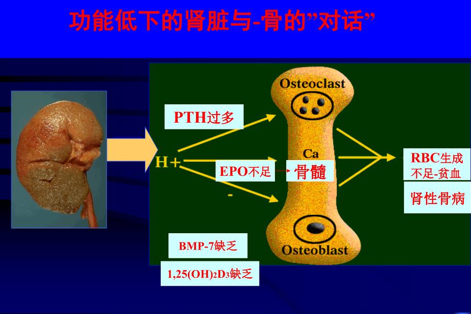 慢性肾脏病骨病_第2页