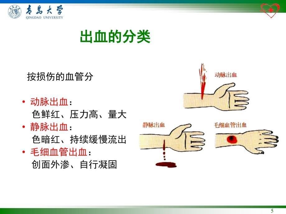 止血包扎_第5页