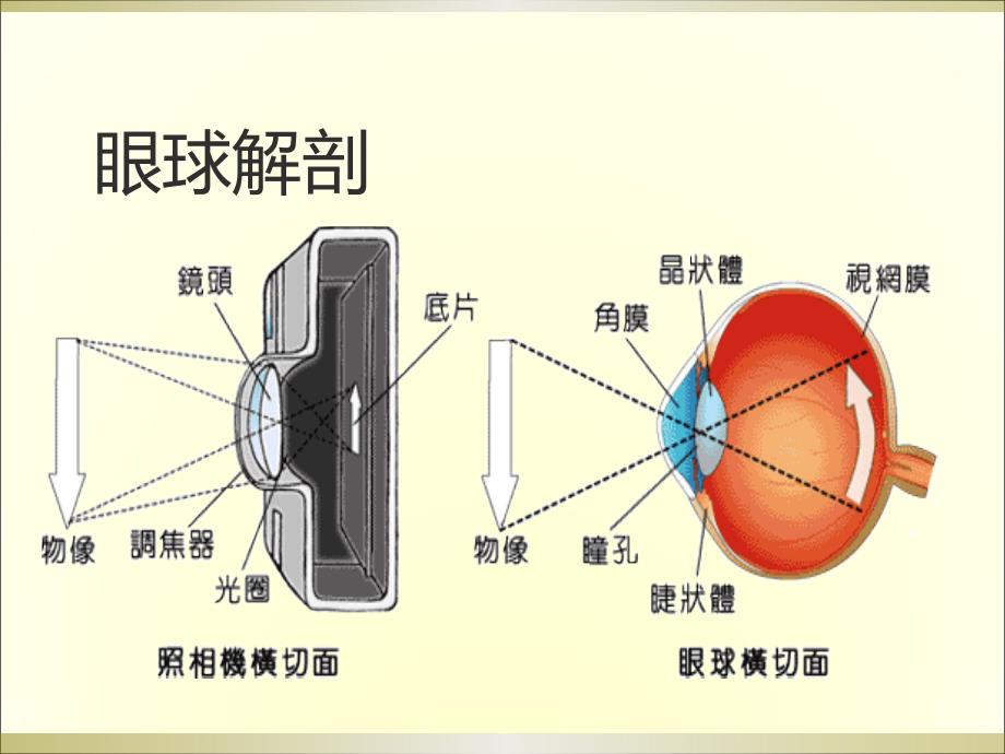 屈光不正斜视弱视课件_第4页