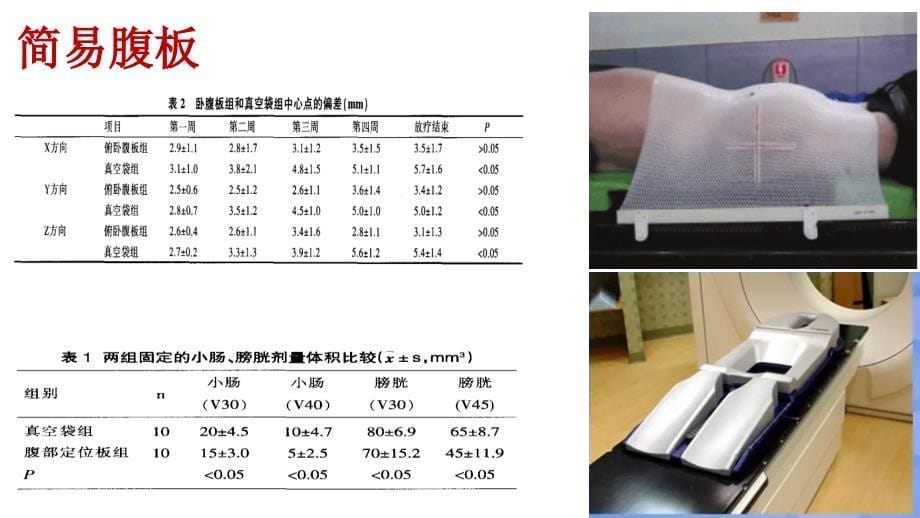 放射治疗中患者的体位重复工作ppt课件_第5页