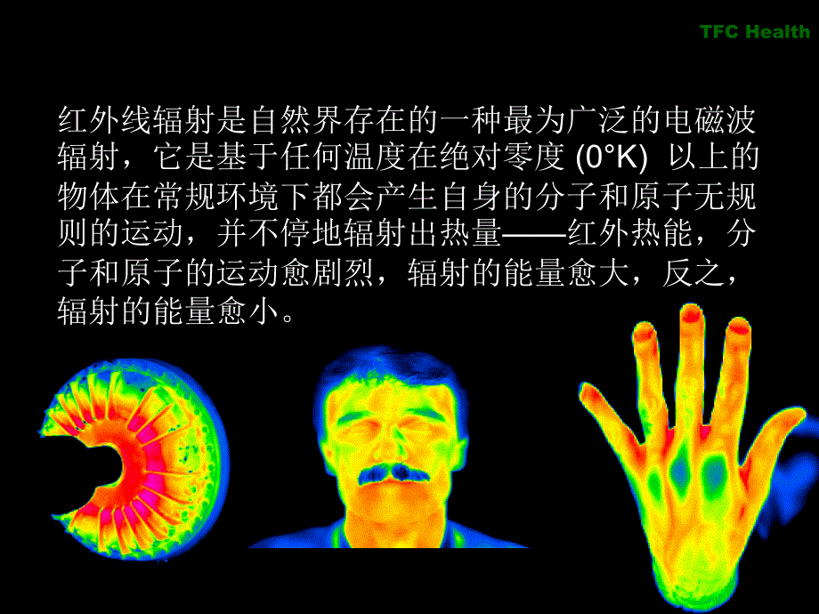 热成像技术在体检中心_第3页