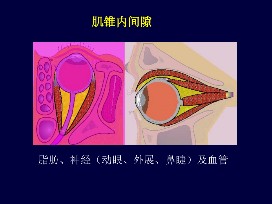 眼眶解剖基础与影像学定位诊断ppt培训课件_第4页