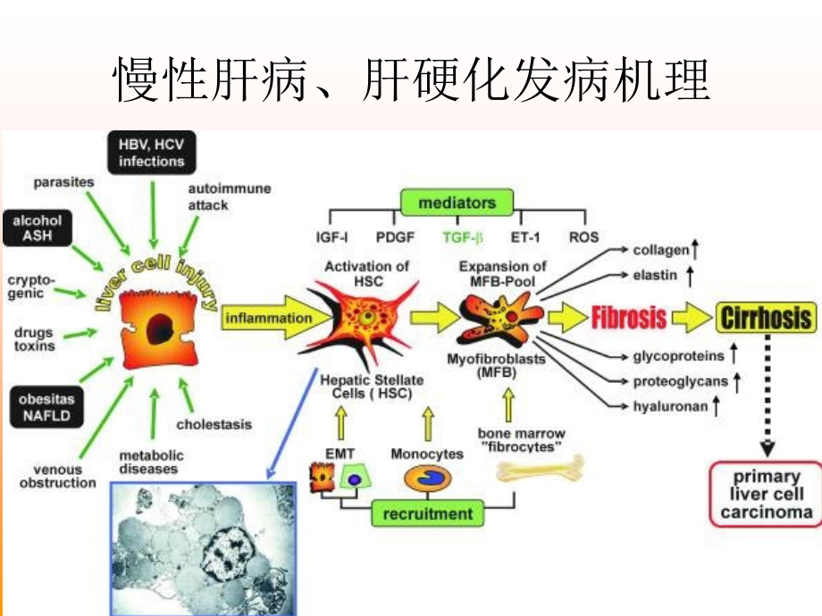 肝癌影像诊断PPT课件_第3页