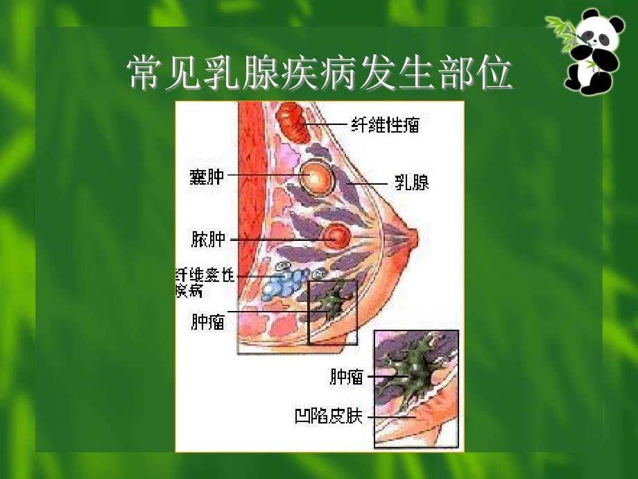 产前产后的乳房保健ppt课件_第3页