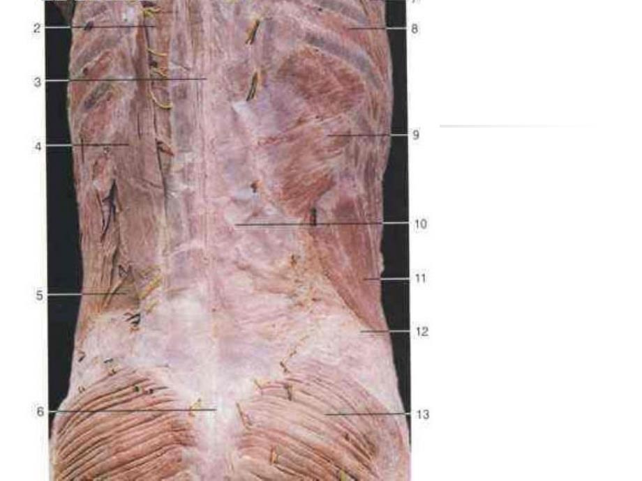 胸腰筋膜与腰肋韧带损伤课件_第4页