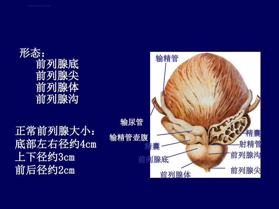 12章4前列腺超声课件_第3页