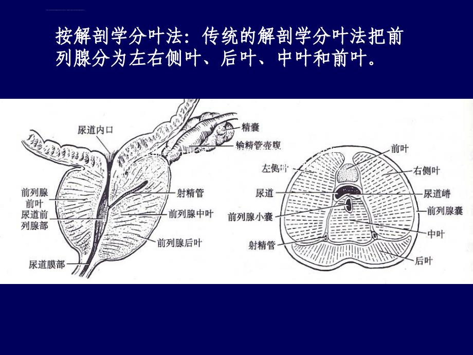 12章4前列腺超声课件_第4页