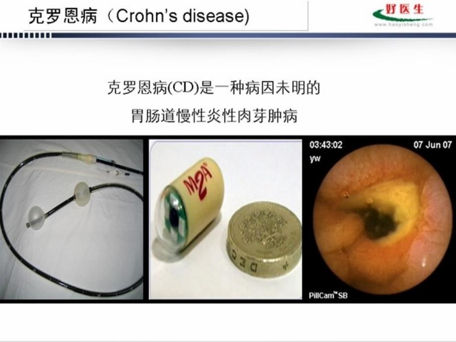 国家级继续医学教育项目之克罗恩病(CD)的治疗_第3页