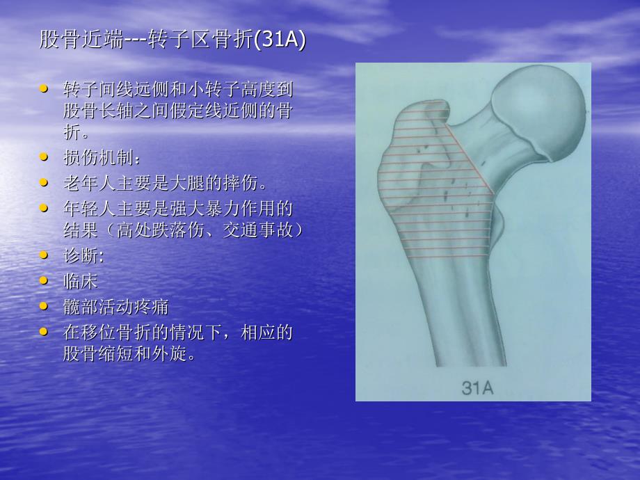 骨折与脱位-诊断分型及治疗四_第2页