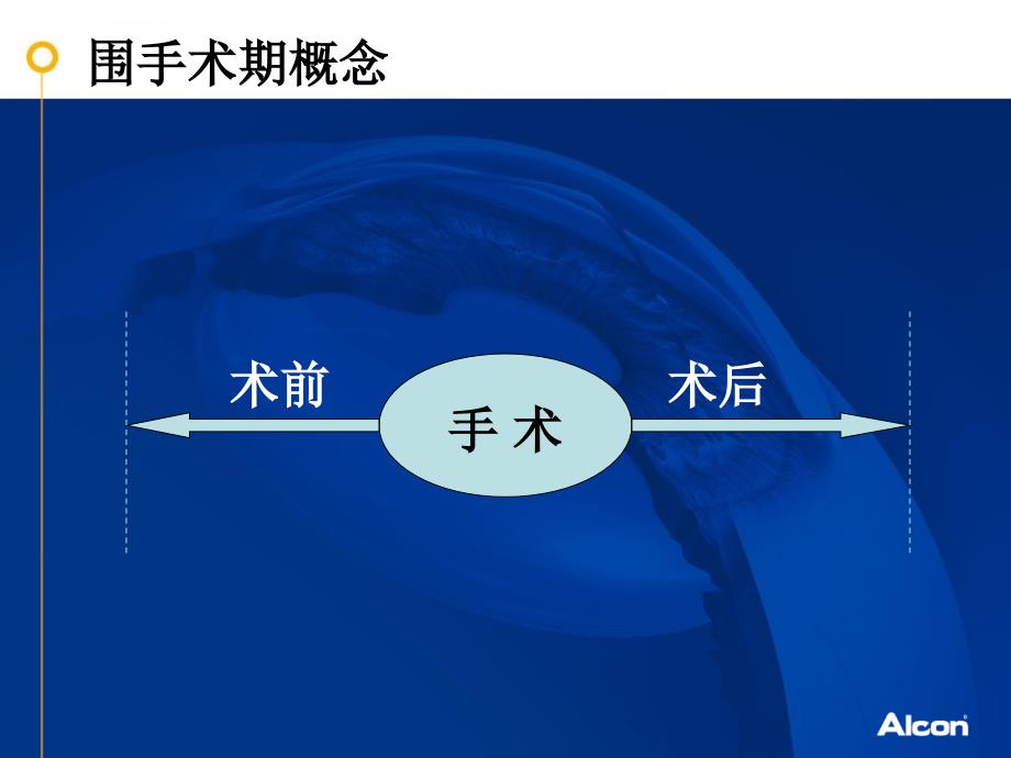 白内障手术围手术期的合理用药ppt课件_第2页