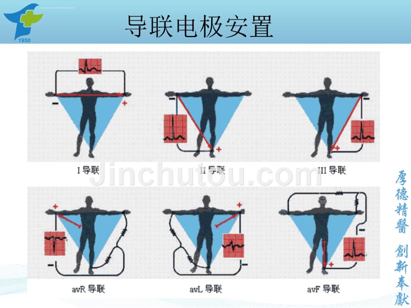 导管室心电图普及ppt课件_第2页