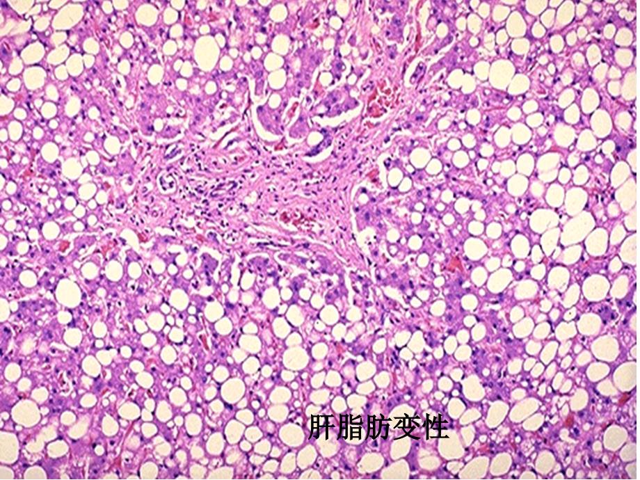 病理图片考试图片库解注版ppt课件_第4页