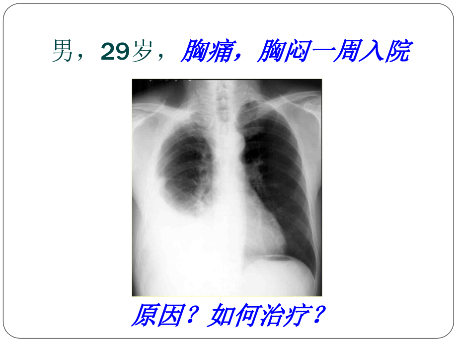 胸膜疾病讲课ppt课件_第1页