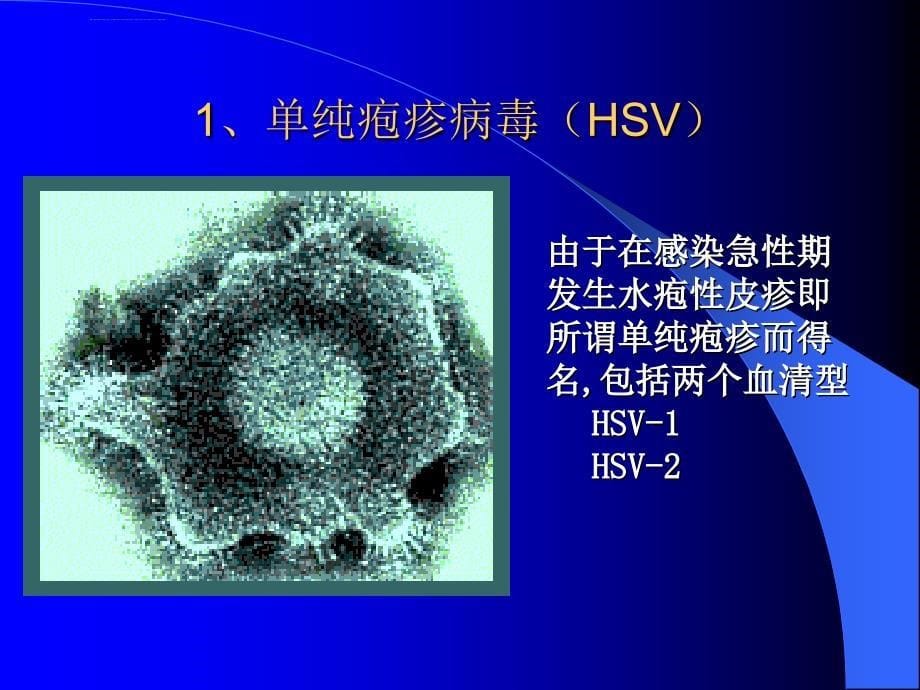 病毒性皮肤病ppt课件_第5页