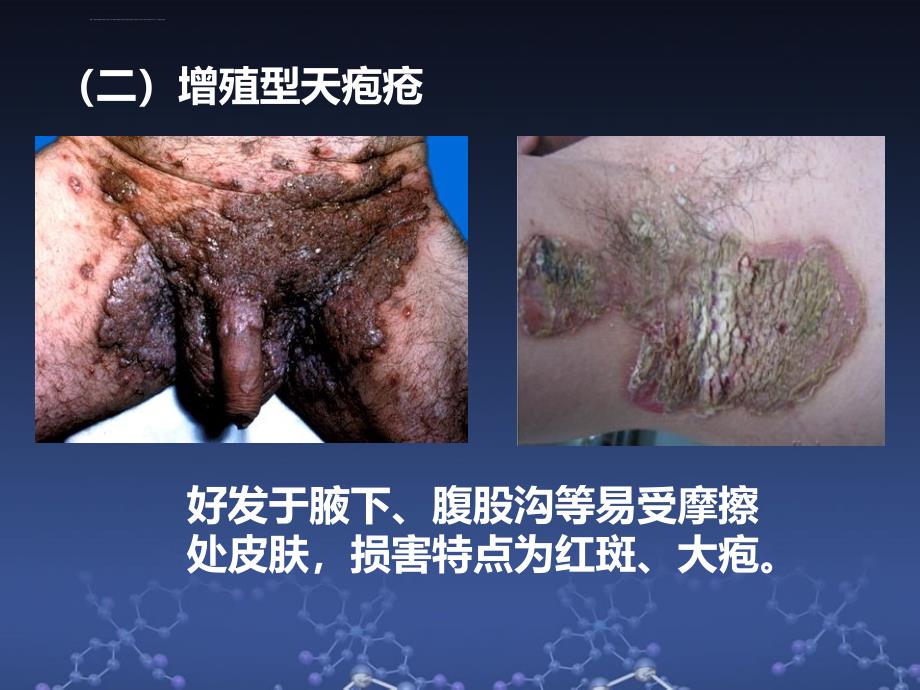 口腔黏膜病学第五章大疱ppt课件_第4页