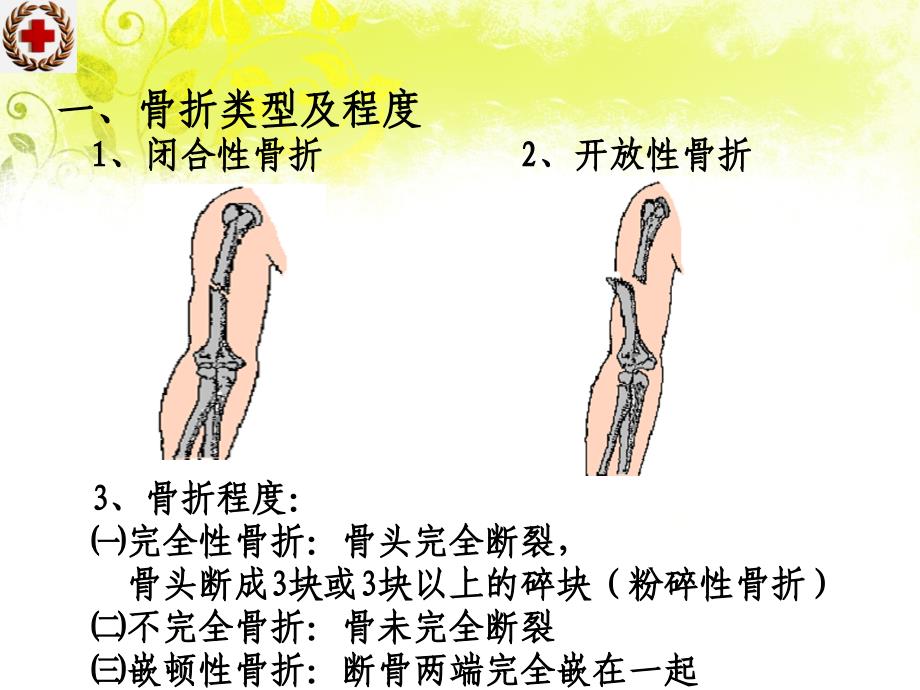 救护医疗常识ppt课件_第4页