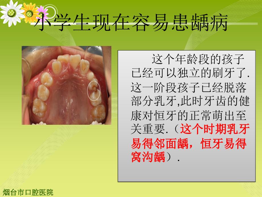 小学生口腔保健课ppt课件_第4页