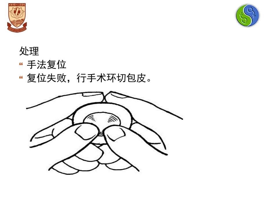 泌尿科常见急诊ppt课件_第5页