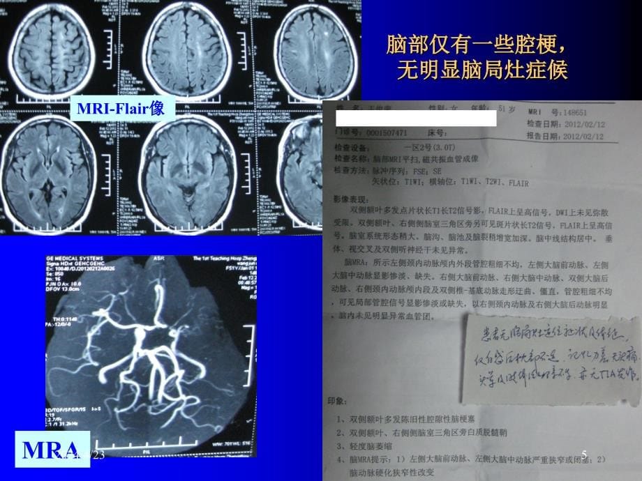 缺血性卒中分型xiouppt课件_第5页