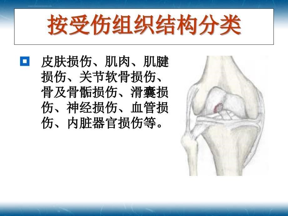 运动损伤概述ppt课件_第5页