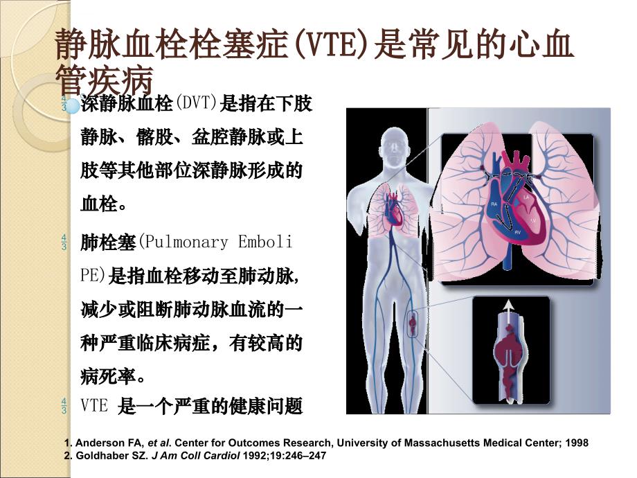 医学ppt--静脉血栓栓塞的介入治疗_第4页