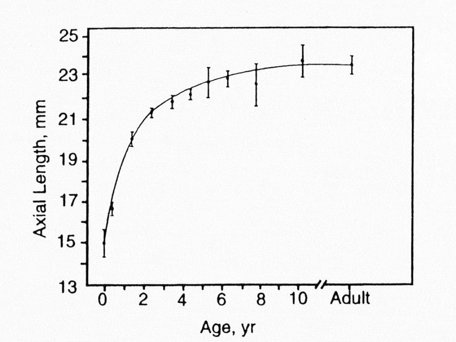 婴幼儿视力检查视光班ppt课件_第5页