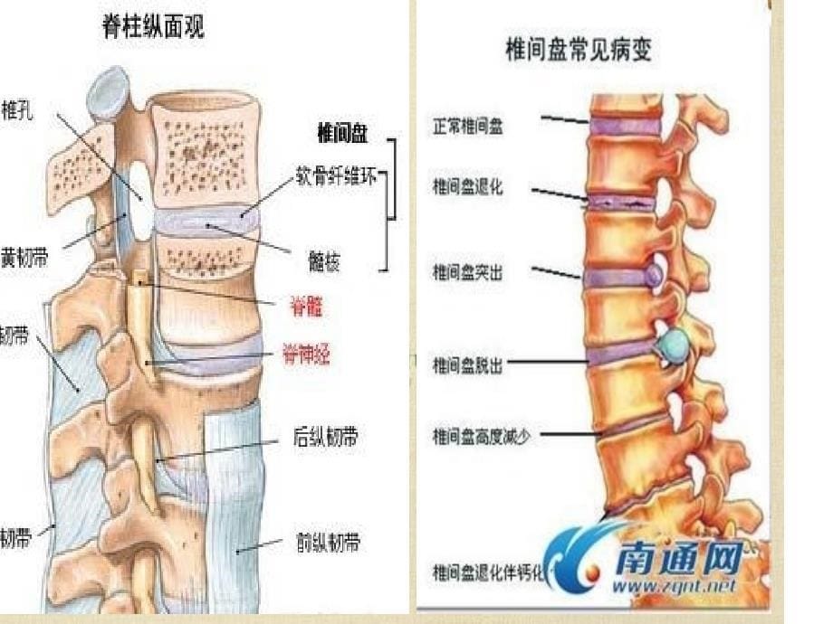 腰椎内固定手术的ppt课件_第5页