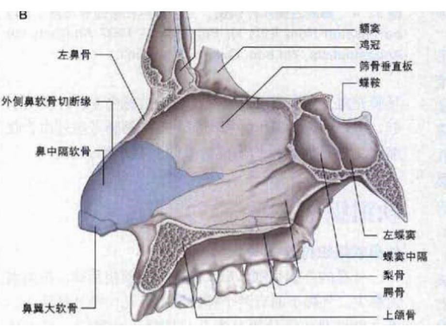 窦口-鼻道复合体影像解剖及临床意义ppt课件_第5页
